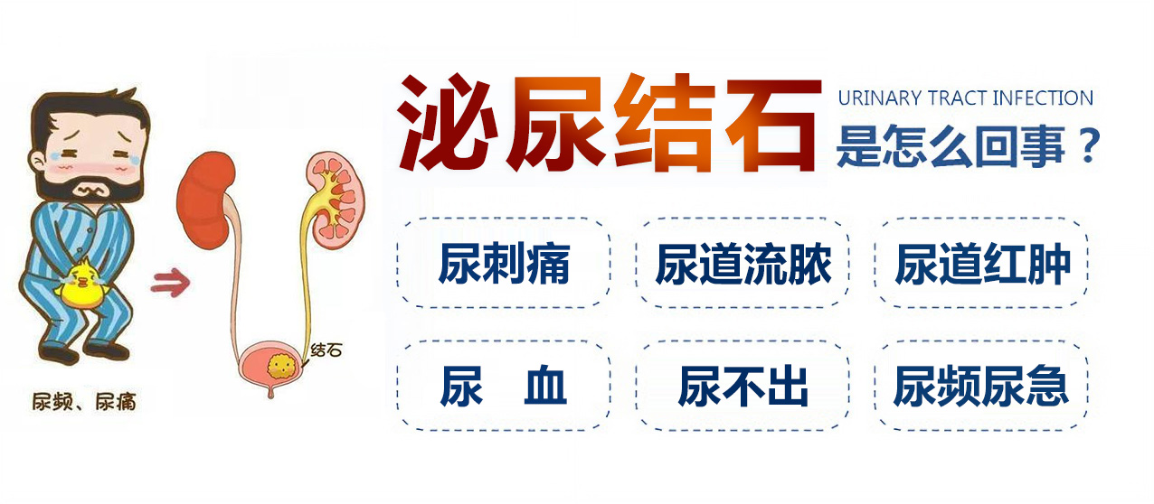 中山泌尿结石，中山结石科，中山结石医院