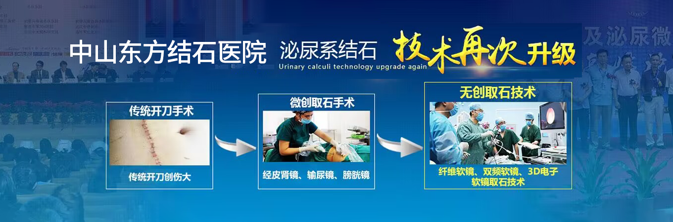 中山泌尿结石,中山结石科,中山结石医院
